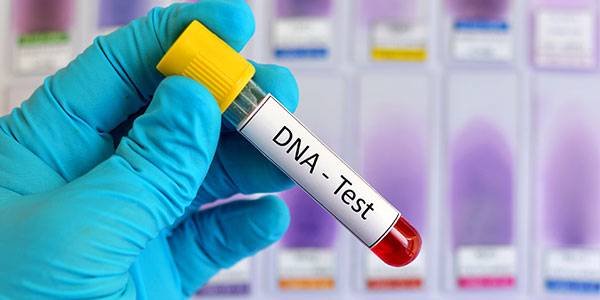 γονιδιακός έλεγχος αλωπεκίας - dna test