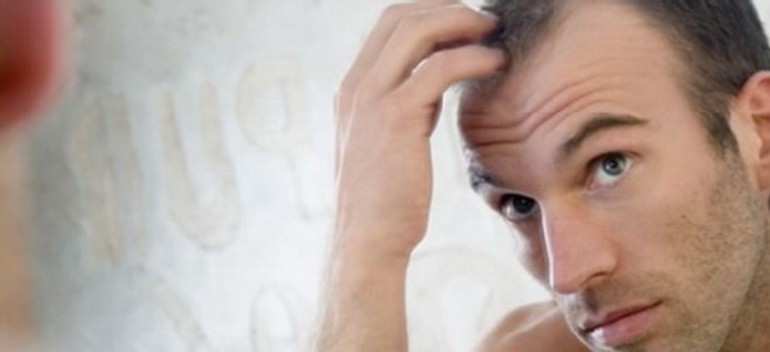 Interesting facts on Hair Transplant Procedure