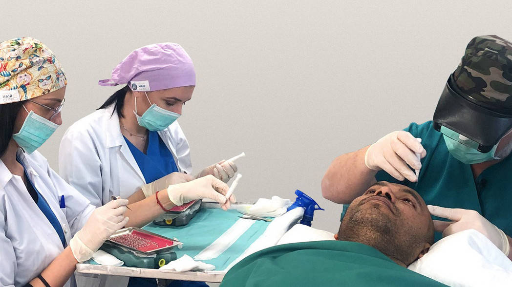 Κόστος και τιμές για τη μεταμόσχευση μαλλιών