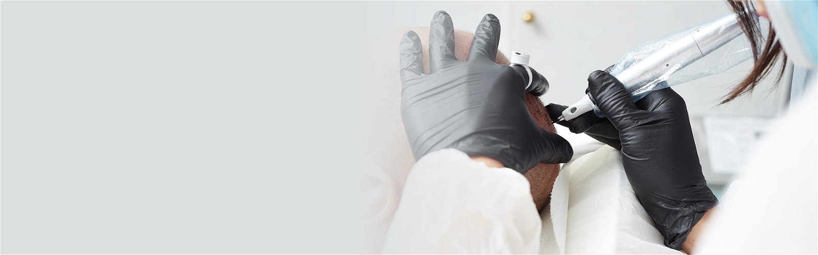 Ιατρικό Tατουάζ Scalp Micropigmentation